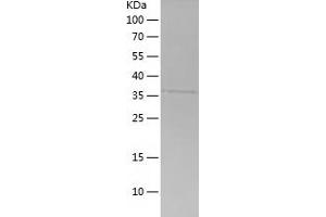 Septin 9 Protein (SEPT9) (AA 117-240) (His-IF2DI Tag)