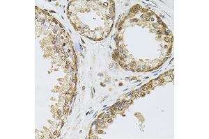 Immunohistochemistry of paraffin-embedded human prostate using POP4 antibody (ABIN6128482, ABIN6145964, ABIN6145966 and ABIN6220640) at dilution of 1:100 (40x lens). (RPP29 Antikörper  (AA 1-220))