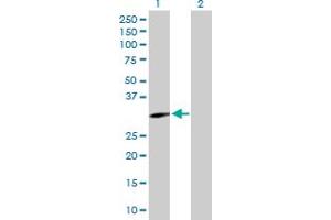 Western Blot analysis of EPHA10 expression in transfected 293T cell line by EPHA10 MaxPab polyclonal antibody. (EPH Receptor A10 Antikörper  (AA 1-295))