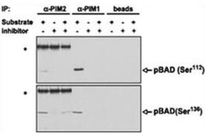 Immunoprecipitation (IP) image for anti-Proto-Oncogene Pim-2 (Serine Threonine Kinase) (PIM2) antibody (ABIN3003584) (PIM2 Antikörper)