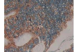 Immunohistochemistry (IHC) image for anti-Prolactin Receptor (PRLR) (AA 25-234) antibody (ABIN7443311)