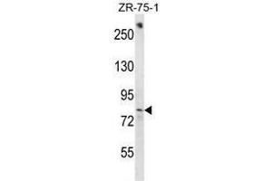 BACH1 Antibody (C-term) western blot analysis in ZR-75-1 cell line lysates (35µg/lane). (BACH1 Antikörper  (C-Term))