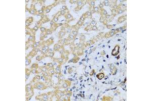 Immunohistochemistry of paraffin-embedded human liver using CSH1 antibody at dilution of 1:100 (40x lens).