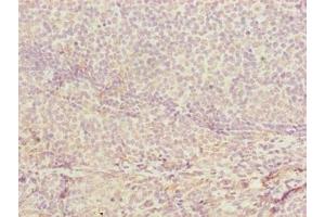 Immunohistochemistry of paraffin-embedded human tonsil tissue using ABIN7149078 at dilution of 1:100 (CDADC1 Antikörper  (AA 1-99))
