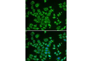 Immunofluorescence analysis of HeLa cell using SMAD1 antibody.