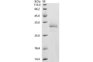 Desmoplakin (DSP) (AA 2600-2822) protein (His tag)