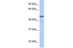 WB Suggested Anti-CALCRL Antibody Titration:  0. (CALCRL Antikörper  (N-Term))