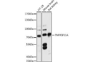 Western blot analysis of extracts of various cell lines, using TNFRSF11A antibody (ABIN6127588, ABIN6149309, ABIN6149311 and ABIN6216817) at 1:3000 dilution. (TNFRSF11A Antikörper  (AA 466-616))