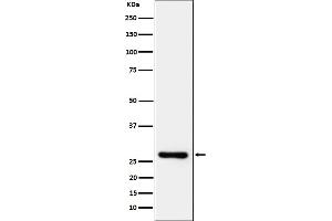 Western blot analysis of DcR1/CD263 expression in Jurkat cell lysate.