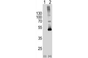 Western blot analysis of SPHK1 antibody and 293T cell lysate either nontransfected (Lane 1) or transiently transfected (2) with the SPHK1 gene.
