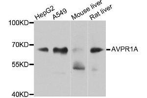 Western blot analysis of extracts of various cells, using AVPR1A antibody. (AVPR1A Antikörper)