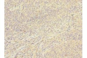Immunohistochemistry of paraffin-embedded human tonsil tissue using ABIN7171407 at dilution of 1:100 (CD8B Antikörper  (AA 22-170))