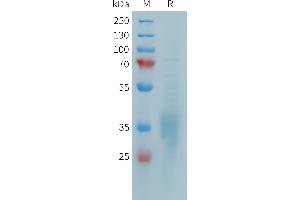 Human CD28 Protein, His Tag on SDS-PAGE under reducing condition.