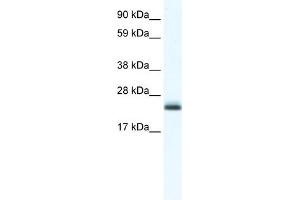WB Suggested Anti-Tppp Antibody Titration:  1. (Tppp Antikörper  (C-Term))