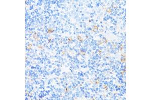 Immunohistochemistry (IHC) image for anti-Integrin alpha-L (ITGAL) (AA 26-306) antibody (ABIN3015542)