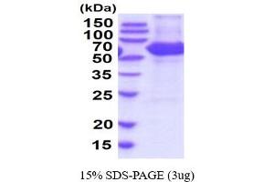 SDS-PAGE (SDS) image for Carboxylesterase 1D (CES1D) (AA 19-565) (Active) protein (His tag) (ABIN7281177)
