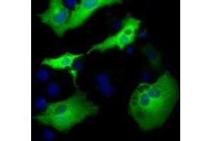 Anti-AK5 mouse monoclonal antibody (ABIN2452722) immunofluorescent staining of COS7 cells transiently transfected by pCMV6-ENTRY AK5 (RC222241). (Adenylate Kinase 5 Antikörper)