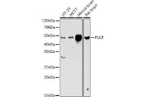 Western blot analysis of extracts of various cell lines, using PLGF antibody (ABIN3015554, ABIN3015555, ABIN3015556 and ABIN6218826) at 1:1000 dilution. (PLGF Antikörper  (AA 19-170))