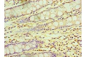 Immunohistochemistry of paraffin-embedded human colon tissue using ABIN7145839 at dilution of 1:100 (KCTD15 Antikörper  (AA 1-234))
