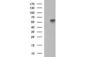 Western Blotting (WB) image for anti-Placental Alkaline Phosphatase (ALPP) antibody (ABIN2715939) (PLAP Antikörper)