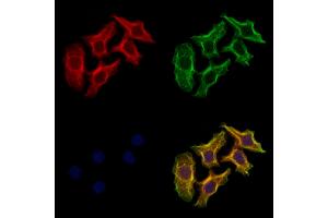 ABIN6261335 and ABIN6273228 staining Hela cells by IF/ICC.