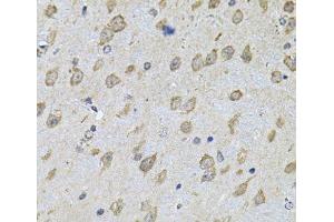 Immunohistochemistry of paraffin-embedded Mouse brain using NFU1 Polyclonal Antibody at dilution of 1:100 (40x lens). (NFU1 Antikörper)
