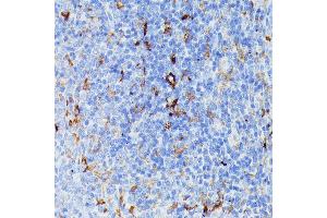 Immunohistochemistry of paraffin-embedded rat spleen using MMP25 antibody (ABIN7268422) at dilution of 1:100 (40x lens).
