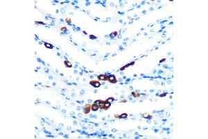 Immunohistochemistry of paraffin-embedded mouse kidney using PIWIL1 Rabbit mAb (ABIN7269381) at dilution of 1:100 (40x lens). (PIWIL1 Antikörper)