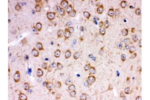 Anti- KCNIP2 Picoband antibody,IHC(P) IHC(P): Rat Brain Tissue (KCNIP2 Antikörper  (N-Term))