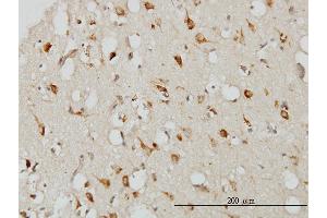 Immunostaining (ISt) image for anti-serpin Peptidase Inhibitor, Clade I (neuroserpin), Member 1 (SERPINI1) (AA 17-410) antibody (ABIN562219)