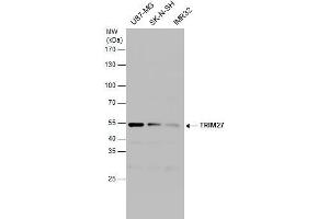 WB Image TRIM27 antibody detects TRIM27 protein by western blot analysis. (TRIM27 Antikörper)