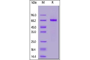 Human Her2 (23-510), His Tag on  under reducing (R) condition. (ErbB2/Her2 Protein (AA 23-510) (His tag))