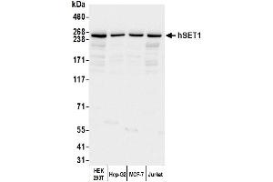 Western Blotting (WB) image for anti-hSET1 (AA 1200-1250) antibody (ABIN7449888) (hSET1 (AA 1200-1250) Antikörper)