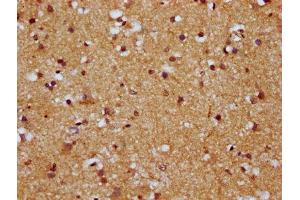 IHC image of ABIN7164031 diluted at 1:500 and staining in paraffin-embedded human brain tissue performed on a Leica BondTM system. (HCN1 Antikörper  (AA 784-887))