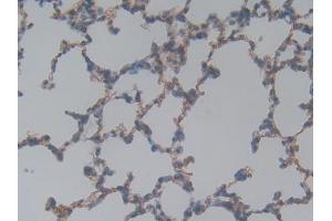 DAB staining on IHC-P; Samples: Rat Lung Tissue (Laminin gamma 1 Antikörper  (AA 1283-1551))