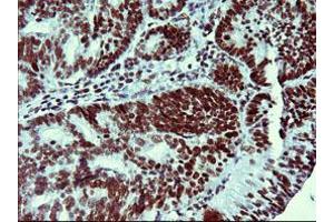 Image no. 1 for anti-Tumor Protein P73 (TP73) (AA 167-409) antibody (ABIN1491005) (Tumor Protein p73 Antikörper  (AA 167-409))