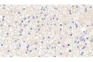 Detection of GSTM1 in Human Liver Tissue using Polyclonal Antibody to Glutathione S Transferase Mu 1 (GSTM1) (GSTM1 Antikörper  (AA 1-218))