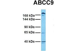 Host:  Rabbit  Target Name:  ABCC9  Sample Tissue:  Human PANC1  Antibody Dilution:  1. (ABCC9 Antikörper  (Middle Region))