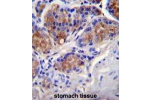 Immunohistochemistry (Paraffin-embedded Sections) (IHC (p)) image for anti-Caspase 12 (Gene/pseudogene) (CASP12) (AA 172-201), (Middle Region) antibody (ABIN951051)