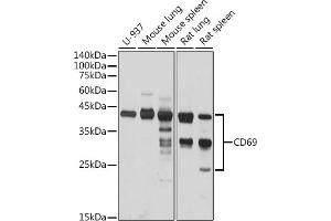 Western blot analysis of extracts of various cell lines, using CD69 antibody (ABIN3022774, ABIN3022775, ABIN3022776 and ABIN6219223) at 1:1000 dilution. (CD69 Antikörper  (AA 62-199))