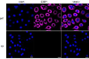 Immunocytochemical staining of HeLa cells using G3BP1 antibody (ABIN7798815), 1:1,000), Top panel: wild-type (WT), Bottom panal: G3BP1 shRNA knockdown (KD). (Rekombinanter G3BP1 Antikörper)