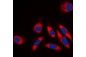 Immunofluorescent analysis of HSP60 staining in NIH3T3 cells.
