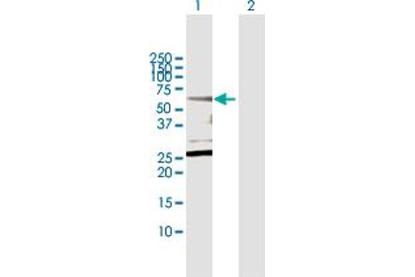 CPNE1 Antikörper  (AA 1-537)