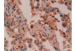 DAB staining on IHC-P; Samples: Human Lung Tissue (Azurocidin Antikörper  (AA 23-247))