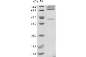 Glypican 3 (GPC3) (AA 25-559) protein (G4S-His Tag)