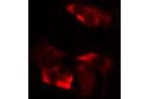 ABIN6277116 staining  HepG2 cells by IF/ICC. (XRCC3 Antikörper  (N-Term))