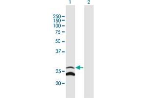 Western Blotting (WB) image for anti-Growth Arrest and DNA-Damage-Inducible, gamma Interacting Protein 1 (GADD45GIP1) (AA 1-222) antibody (ABIN530001)