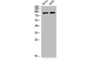 Western Blot analysis of HELA 293T cells using Phospho-GR (S226) Polyclonal Antibody (Glucocorticoid Receptor Antikörper  (pSer226))