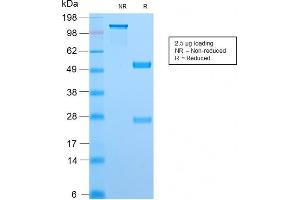 SDS-PAGE Analysis Purified Topo I Rabbit Recombinant Monoclonal Antibody (TOP1MT/2883R). (Rekombinanter TOP1MT Antikörper)