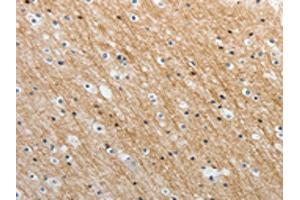 Immunohistochemistry (IHC) image for anti-ADAM Metallopeptidase with Thrombospondin Type 1 Motif, 19 (ADAMTS19) antibody (ABIN7189659)